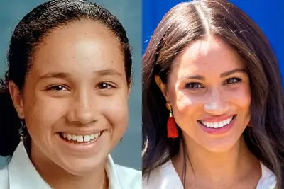До и после: как изменились звезды с винирами на зубах