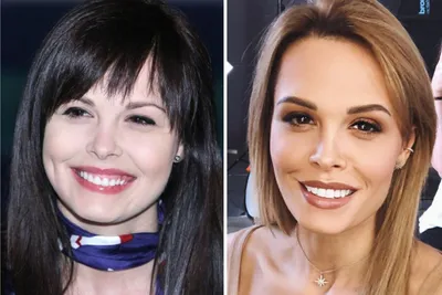 Звездные улыбки: как новые зубы меняют внешность знаменитостей - 7Дней.ру