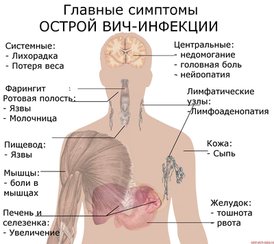 Ранние симптомы ВИЧ-инфекции.» — Яндекс Кью