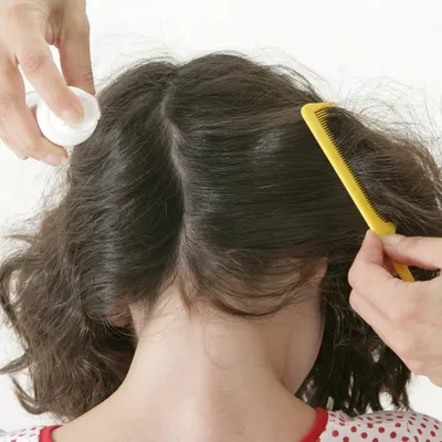 Вши в волосах – откуда берутся, как распространяются и лучшие методы  лечения - Телеграф