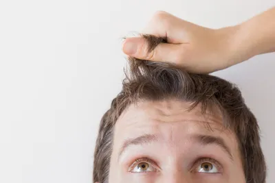 Выпадение волос у мужчины [причины и что делать]