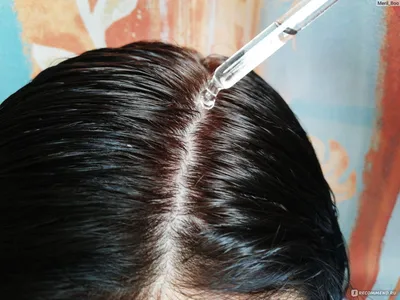 Лосьон дерматологический против выпадения волос Orising Hair Care -  «Волосопад осенью всем знаком? А после отмены ОК? Лосьон за 4000 руб.  спасет волосы или нет.» | отзывы