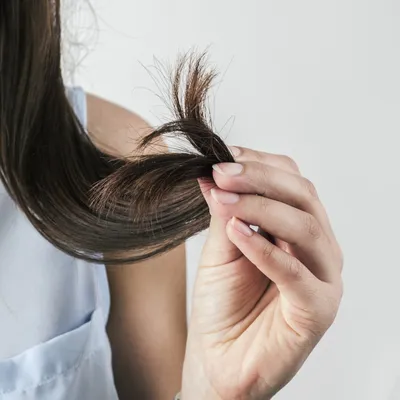 Трихолог — о выпадении волос, правильном уходе и плазмотерапии | РБК Стиль