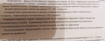 Магнитно–резонансная томография (МРТ) шейного отдела позвоночника - «Больше  всего боялась, что нужно не двигаться 20 минут с моим частым  головокружением, думала не получится. Но все прошло хорошо благодаря одному  лайфхаку, который я