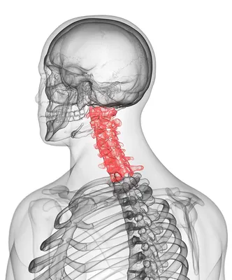 Грыжа шейного отдела позвоночника - Клиника вертеброневрологии