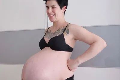 Mãe de 3 mostra antes e depois da barriga e diferença é chocante –  Pais\u0026Filhos