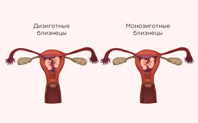 Просто была двойня и «все всё понимали», – откровения мамы двойняшек спустя  год после родов.