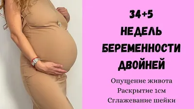 СКОРО РОДЫ😱|34+5 недель беременности двойней|Опущение живота|Раскрытие 1  см|Сглаживание шейки матки - YouTube