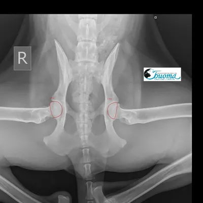 Дисплазия тазобедренных суставов. — Биота