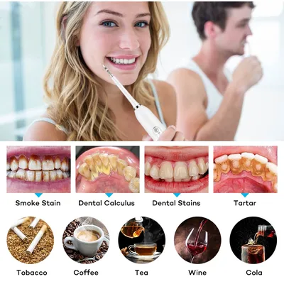 Ультразвуковой Электрический стоматологический аппарат для удаления зубного  камня звуковой зубной камень для отбеливания зубов ирригатор для удаления  зубного камня для ухода за зубами - купить по выгодной цене | AliExpress