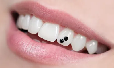 Красивые камни на зубах - особый шик