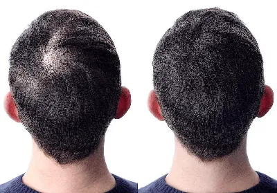 Камуфляж волос для мужчин | Салон красоты Inkanto