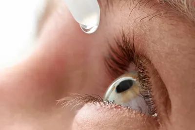 Возможно ли лечение катаракты нехирургическим путем | «Визиум»