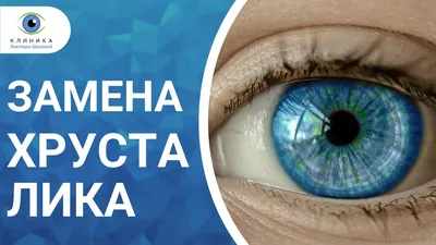 Замена хрусталика глаза при катаракте - цена операции в Москве
