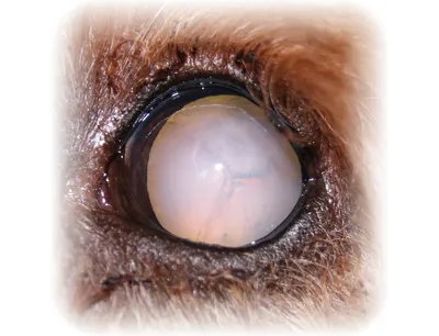 Удаление катаракты – возможные риски после операции - Офтальмологические  клиники «Эксимер» (Киев) – диагностика и лечение заболеваний глаз у  взрослых и детей