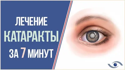 Что такое катаракта? | Théa