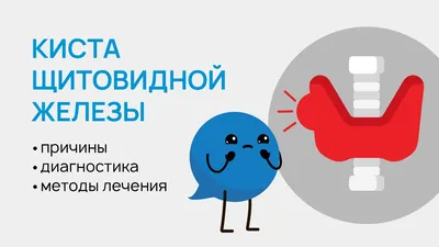 Киста щитовидной железы: причины, симптомы и лечение в статье эндокринолога  Матвеева М. В.