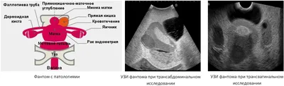 Ультразвуковой фантом органов женского таза ОМТ Ref.US-10 Female Pelvic  Ultrasound Phantom | ООО НПП \"Доза\"