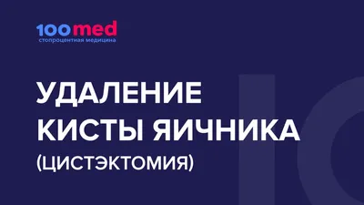 Цистэктомия | Удаление кисты яичника в 100med