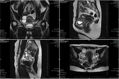 МРТ органов малого таза у женщин - цена в Москве, сделать  магнитно-резонансную томографию