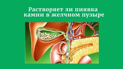 Гирудотерапия при лечении желчного пузыря в Москве в МЦ «Здоровая семья» -  Здоровая Семья