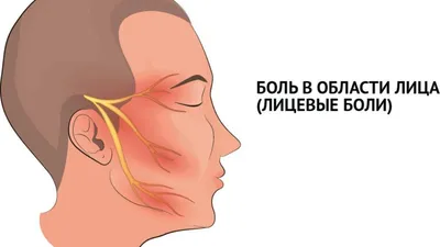 Боль в лице: причины, виды, лечение | МЦ AXON (Херсон).