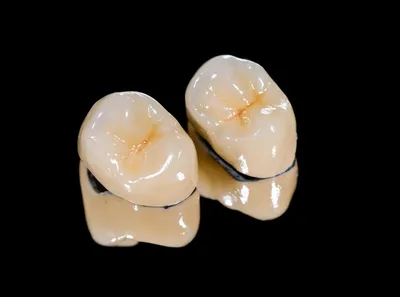 Металлокерамика или цирконий для коронок, что лучше при протезировании зубов