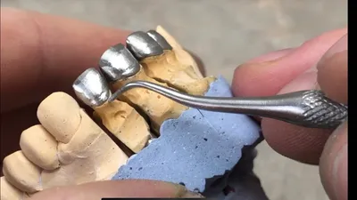 Изготовление фронтальных одиночных коронок с плечевой массой ЧАСТЬ 2.  Зубной техник. Видео курс - YouTube