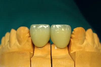 Лаборатория - Prodeo Dental Technology