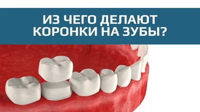 Металлокерамическая коронка: цена в Москве, сколько стоит коронка на зуб из  металлокерамики
