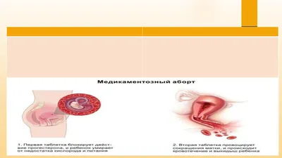 Акушер-гинеколог о вреде абортов и о праве выбора женщины - 14 октября 2021  - 63.ru