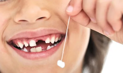 Коренные и молочные зубы | сколько молочных зубов - центр стоматологии  «Тихонова» в Туле