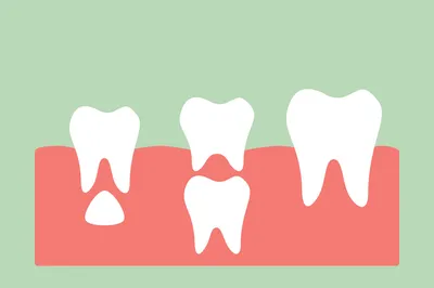 Статья о стоматологии: Лечение молочных зубов