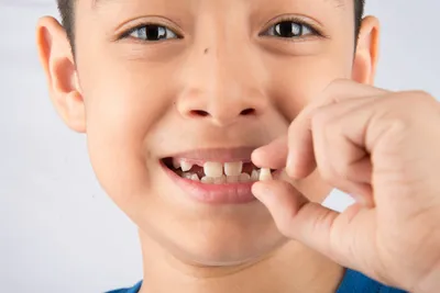 Как отличить молочный зуб от коренного? | DentConsult | Дзен