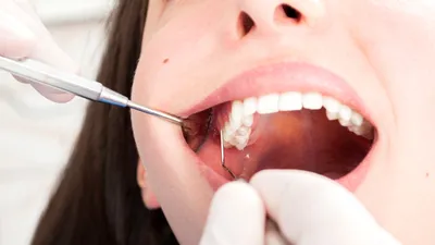 Когда же наконец зубной врач сможет вырастить нам новый зуб? - BBC News  Русская служба