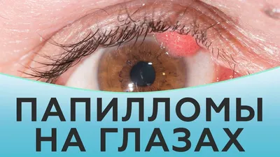 Общество офтальмологов России | Moscow