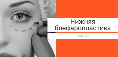 Нижняя блефаропластика цена | Блефаропластика нижних век в Минске стоимость