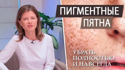 Пигментные пятна на лице - как избавиться (при беременности \\ после родов \\  после 40 лет) - YouTube