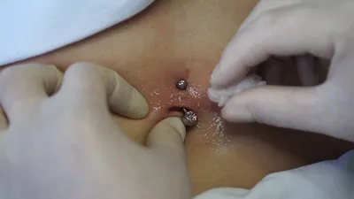 Пирсинг прокол пупка | косметология Самара | belly piercing - YouTube