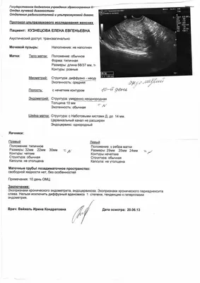 Эндометриоз на узи - Вопрос гинекологу - 03 Онлайн