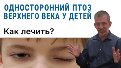 Односторонний птоз верхнего века у детей. Как лечить?