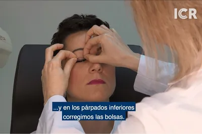 Блефаропластика | Офтальмологический Центр ICR