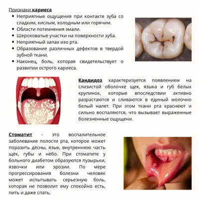 ИнфоТаганрог - Онкоскрининг полости рта