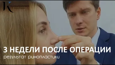 КАК ВЫГЛЯДИТ НОС ЧЕРЕЗ 3 НЕДЕЛИ ПОСЛЕ РИНОПЛАСТИКИ - YouTube