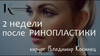 Открытая риносептопластика - пластический хирург Владимир Косинец - YouTube