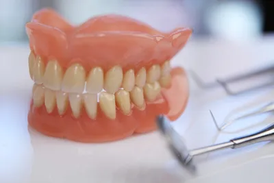 Все о съемных зубных протезах