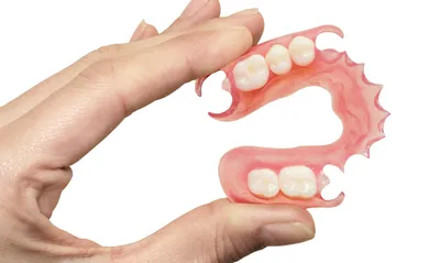 Мягкие съемные зубные протезы — какой лучше выбрать?
