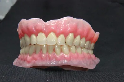 Зубные съемные протезы при полном отсутствии зубов в Кисловодске недорого в  клинике \"Современная стоматология\"