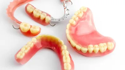 Съемное протезирование при полном отсутствии зубов | Цены на съемные зубные  протезы в стоматологии «АСТРА» во Владимире