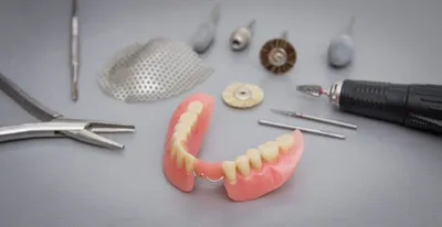 Съемные зубные протезы, установка протезов в Днепре | Клиника  «СТОМАТОЛОГ-ОРТОДОНТ»